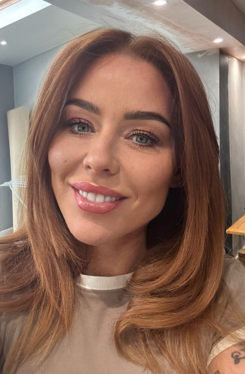Chemical Peel Treatment in Liverpool