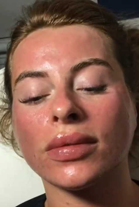 Hifu Treatment in Liverpool