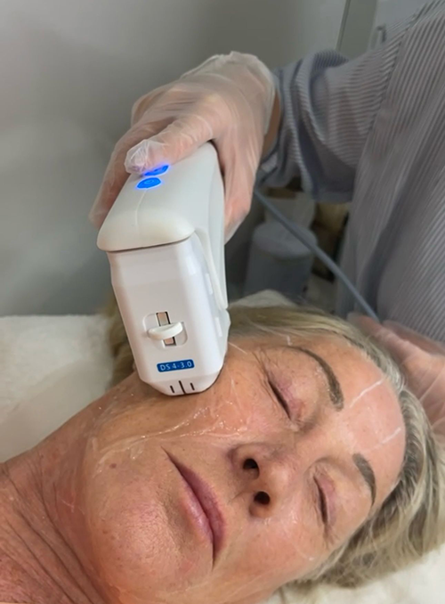 Hifu Treatment in Liverpool