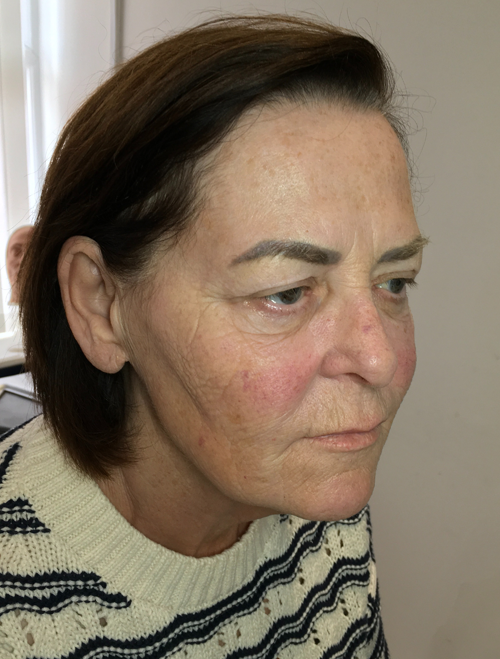 Polynucleotide Treatments Liverpool